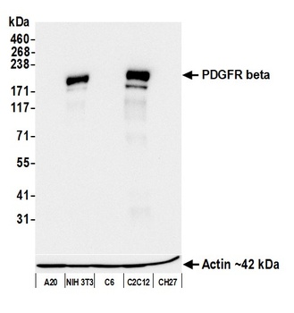 Rabbit anti-PDGFR beta Recombinant Monoclonal Antibody [BLR242L]