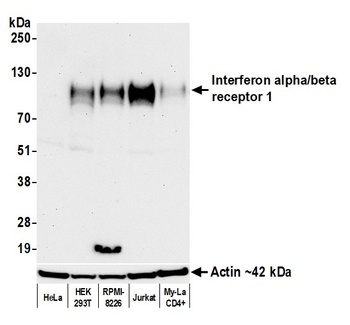 Rabbit anti-Interferon alpha/ beta receptor 1 Recombinant Monoclonal Antibody [BLR265L]