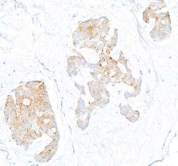 Rabbit anti-LOX-1 Recombinant Monoclonal Antibody [BLR262L]