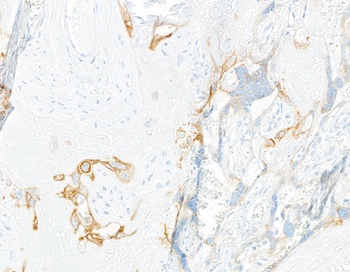 Rabbit anti-LOX-1 Recombinant Monoclonal Antibody [BLR262L]