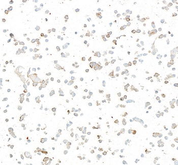 Rabbit anti-LOX-1 Recombinant Monoclonal Antibody [BLR262L]