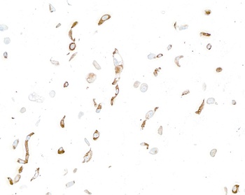 Rabbit anti-LOX-1 Recombinant Monoclonal Antibody [BLR262L]