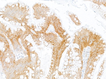 Rabbit anti-LOX-1 Recombinant Monoclonal Antibody [BLR262L]