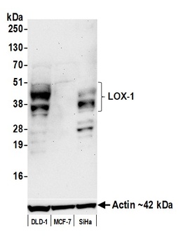 Rabbit anti-LOX-1 Recombinant Monoclonal Antibody [BLR262L]