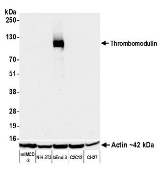 Rabbit anti-Thrombomodulin Recombinant Monoclonal Antibody [BLR260L]