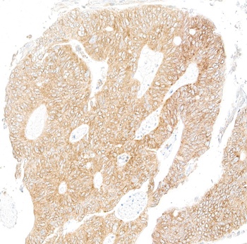 Rabbit anti-LYRIC/AEG1 Recombinant Monoclonal Antibody [BLR258L]