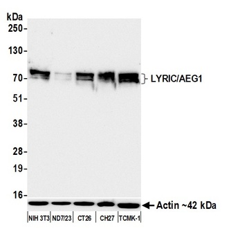 Rabbit anti-LYRIC/AEG1 Recombinant Monoclonal Antibody [BLR258L]