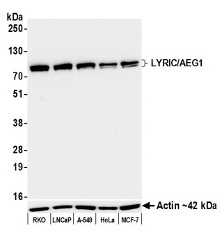 Rabbit anti-LYRIC/AEG1 Recombinant Monoclonal Antibody [BLR258L]