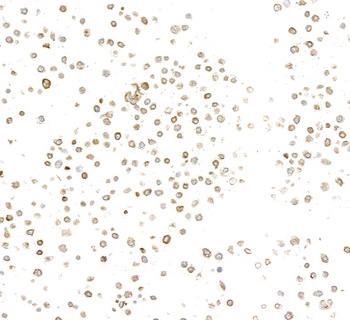 Rabbit anti-LYRIC/AEG1 Recombinant Monoclonal Antibody [BLR258L]