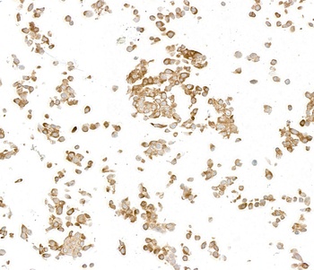 Rabbit anti-LYRIC/AEG1 Recombinant Monoclonal Antibody [BLR258L]
