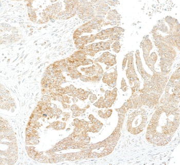Rabbit anti-LYRIC/AEG1 Recombinant Monoclonal Antibody [BLR258L]
