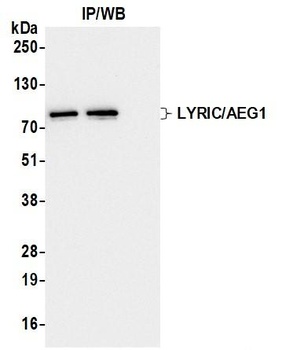Rabbit anti-LYRIC/AEG1 Recombinant Monoclonal Antibody [BLR258L]