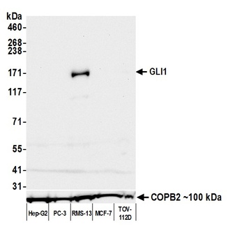 Rabbit anti-GLI1 Recombinant Monoclonal Antibody [BLR256L]