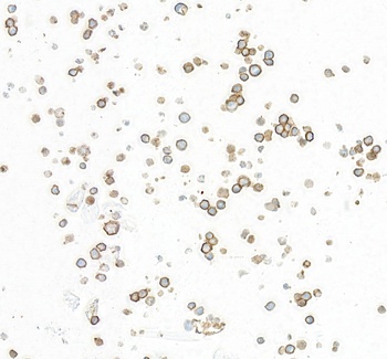 Rabbit anti-CD86 Recombinant Monoclonal Antibody [BLR255L]