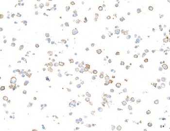 Rabbit anti-CD86 Recombinant Monoclonal Antibody [BLR255L]