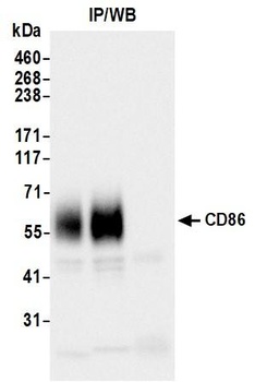 Rabbit anti-CD86 Recombinant Monoclonal Antibody [BLR255L]
