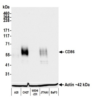 Rabbit anti-CD86 Recombinant Monoclonal Antibody [BLR255L]