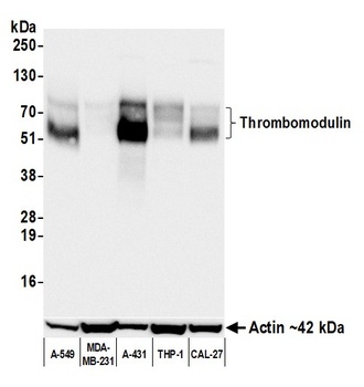 Rabbit anti-Thrombomodulin Recombinant Monoclonal Antibody [BLR253L]