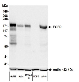 Rabbit anti-EGFR Recombinant Monoclonal Antibody [BLR251L]