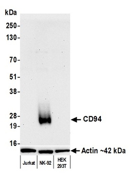 Rabbit anti-CD94 Recombinant Monoclonal Antibody [BLR264L]