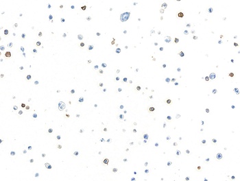 Rabbit anti-c-Kit Recombinant Monoclonal Antibody [BLR263L]