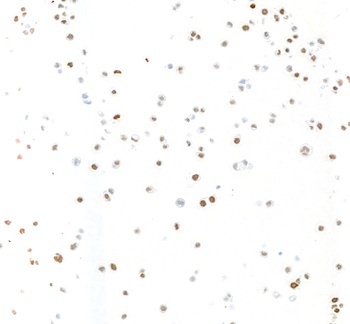 Rabbit anti-KLF5 Recombinant Monoclonal Antibody [BLR243L]