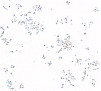 Rabbit anti-KLF5 Recombinant Monoclonal Antibody [BLR243L]