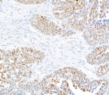 Rabbit anti-KLF5 Recombinant Monoclonal Antibody [BLR243L]