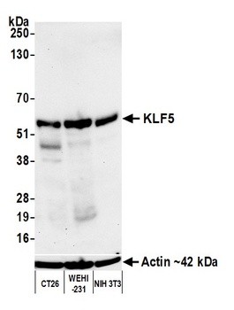 Rabbit anti-KLF5 Recombinant Monoclonal Antibody [BLR243L]