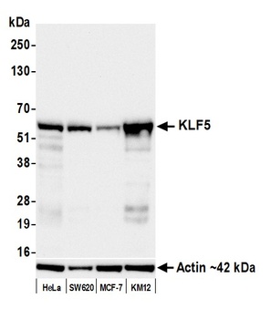 Rabbit anti-KLF5 Recombinant Monoclonal Antibody [BLR243L]