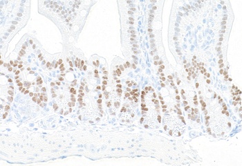Rabbit anti-KLF5 Recombinant Monoclonal Antibody [BLR243L]