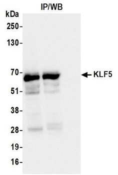 Rabbit anti-KLF5 Recombinant Monoclonal Antibody [BLR243L]