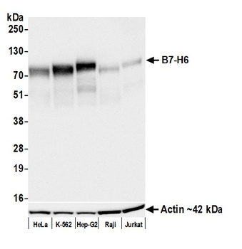 Rabbit anti-B7-H6 Recombinant Monoclonal Antibody [BLR271L]