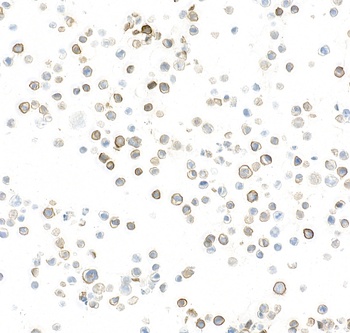 Rabbit anti-P-Selectin/CD62P Recombinant Monoclonal Antibody [BLR268L]