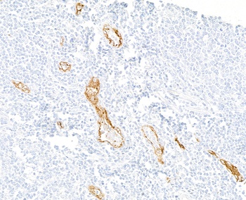 Rabbit anti-P-Selectin/CD62P Recombinant Monoclonal Antibody [BLR268L]