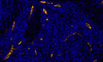 Rabbit anti-P-Selectin/CD62P Recombinant Monoclonal Antibody [BLR268L]