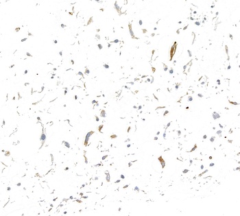 Rabbit anti-P-Selectin/CD62P Recombinant Monoclonal Antibody [BLR268L]