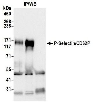 Rabbit anti-P-Selectin/CD62P Recombinant Monoclonal Antibody [BLR268L]