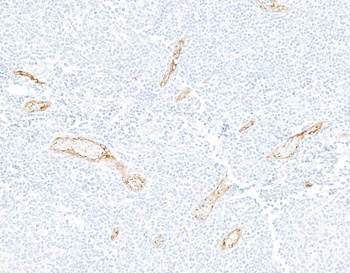 Rabbit anti-P-Selectin/CD62P Recombinant Monoclonal Antibody [BLR267L]