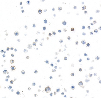 Rabbit anti-P-Selectin/CD62P Recombinant Monoclonal Antibody [BLR267L]