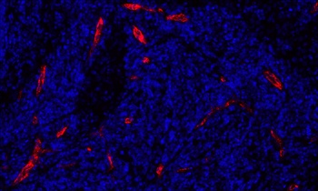 Rabbit anti-P-Selectin/CD62P Recombinant Monoclonal Antibody [BLR267L]