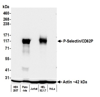 Rabbit anti-P-Selectin/CD62P Recombinant Monoclonal Antibody [BLR267L]