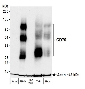 Rabbit anti-CD70 Recombinant Monoclonal Antibody [BLR266L]