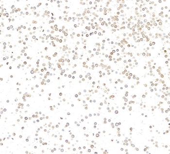 Rabbit anti-CD36 Recombinant Monoclonal Antibody [BLR259L]