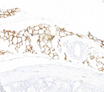 Rabbit anti-CD36 Recombinant Monoclonal Antibody [BLR259L]