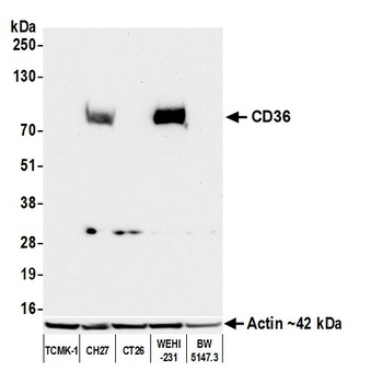 Rabbit anti-CD36 Recombinant Monoclonal Antibody [BLR259L]