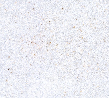 Rabbit anti-CTLA4 Recombinant Monoclonal Antibody [BLR257L]