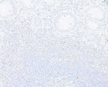 Rabbit anti-CTLA4 Recombinant Monoclonal Antibody [BLR257L]