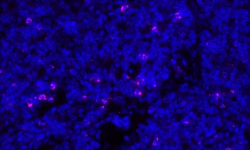 Rabbit anti-CTLA4 Recombinant Monoclonal Antibody [BLR257L]