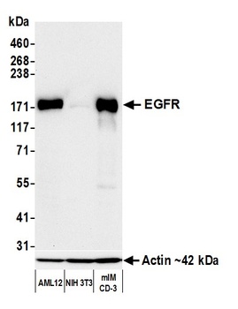 Rabbit anti-EGFR Recombinant Monoclonal Antibody [BLR252L]